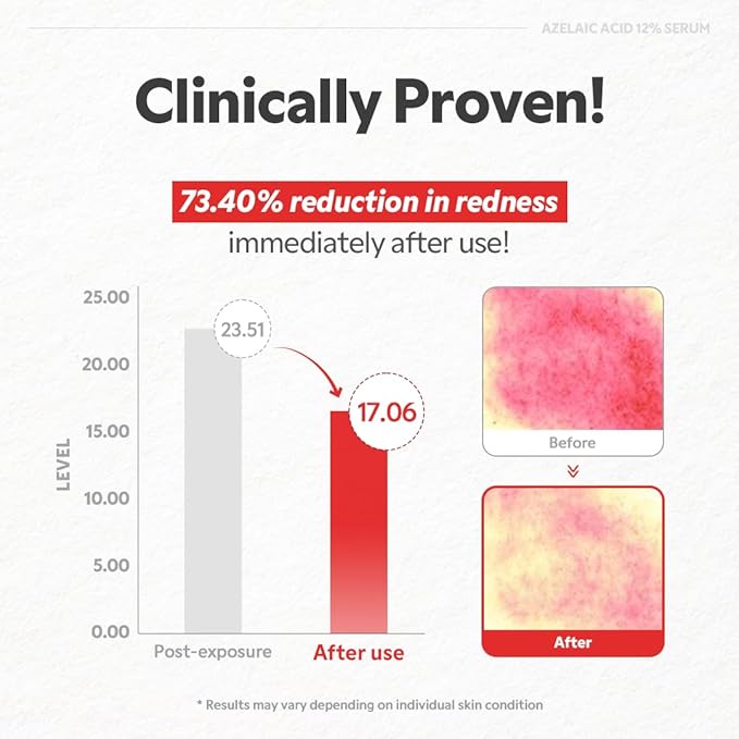 TIRTIR- Azelaic Acid 12% Serum