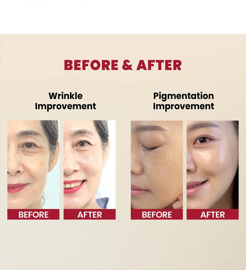 KSECRET - SEOUL 1988 Serum: Retinal Liposome 2% + Black Ginseng