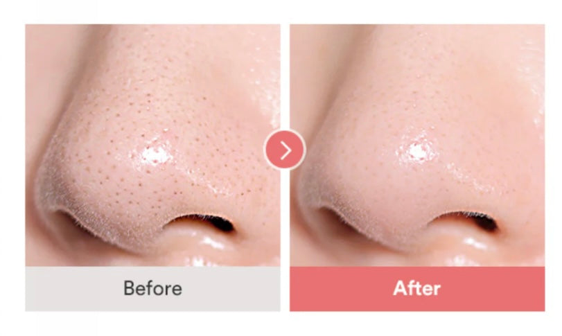 Calamine pore Control Cleansing Oil