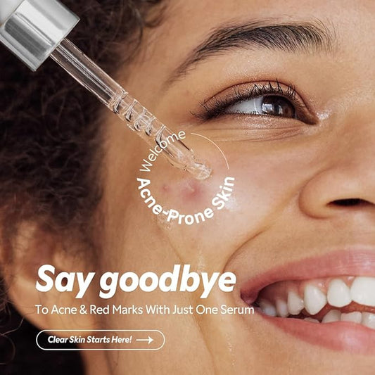 TIRTIR- Azelaic Acid 12% Serum